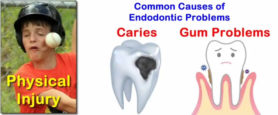 Physical Trauma Such as Altercations or Sporting Accidents Can Lead To Tooth or Gum Problems